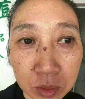 去老年斑的簡(jiǎn)單方法，重拾肌膚光彩的秘訣，去老年斑秘籍，重拾肌膚光彩的簡(jiǎn)易方法