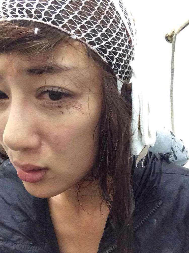 明星整容毀容最嚴(yán)重的是誰，深度探討與反思，深度探討與反思，哪位明星整容遭遇最慘重的毀容？