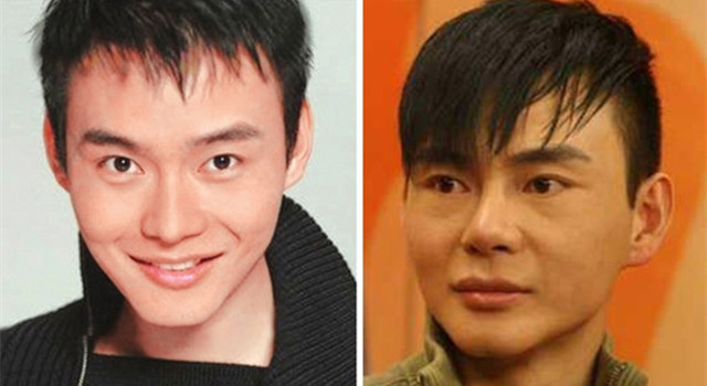 整過容的男明星名單，揭秘娛樂圈的顏值變革之旅，揭秘娛樂圈顏值變革之旅，整過容的男明星名單曝光