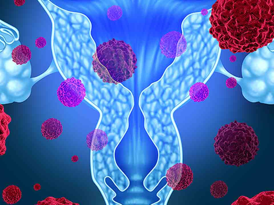 尖銳濕疣會自愈嗎？深入了解尖銳濕疣及其治療，尖銳濕疣能否自愈？全面解析尖銳濕疣及其治療方法