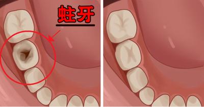 智齒，口腔健康的關(guān)鍵要素與智齒SEO的重要性，智齒，口腔健康的關(guān)鍵與SEO優(yōu)化的重要性