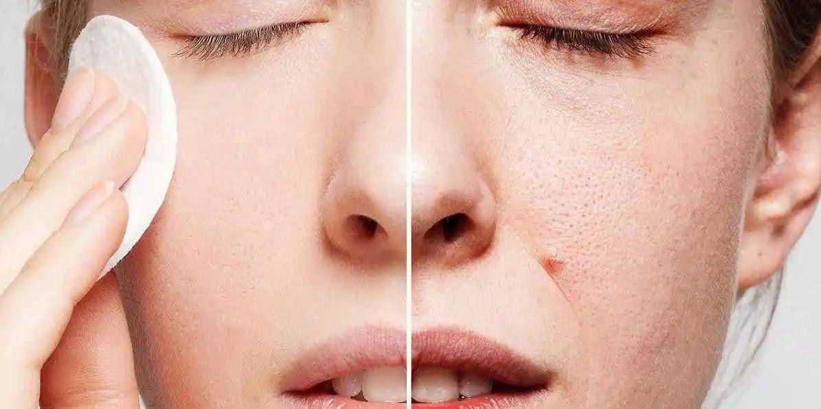 如何有效收縮毛孔，方法與技巧解析，毛孔收縮秘籍，方法與技巧全面解析