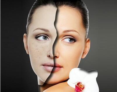 如何祛斑，探索最有效的祛斑方法，探索最有效的祛斑方法，告別斑點(diǎn)困擾！