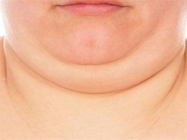 如何有效去除雙下巴贅肉——實用指南，實用指南，如何有效去除雙下巴贅肉