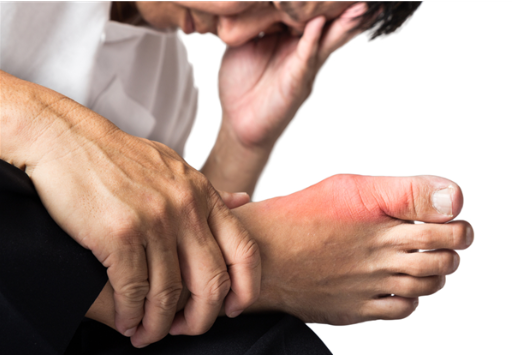 降低尿酸高，飲食調(diào)整與天然食物選擇，飲食調(diào)整與天然食物選擇助力降低尿酸高