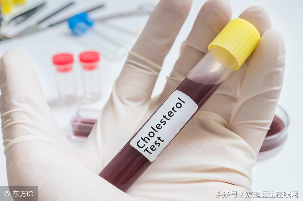 糖尿病的成因，深度解析其背后的原因，深度解析糖尿病成因，揭示背后原因真相