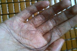 為什么有錢人不去植發(fā)，深度解析背后的原因，深度解析，有錢人為什么不去植發(fā)的原因