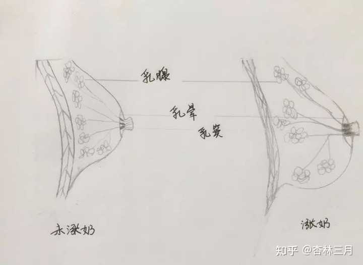 乳房硬塊消除，了解成因與應(yīng)對(duì)方法，乳房硬塊消除，成因解析與應(yīng)對(duì)方法指南