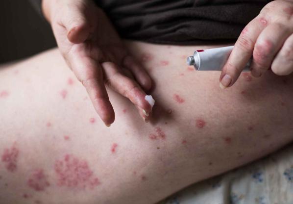 鼻咽癌前期的18種預(yù)兆及其重要性，鼻咽癌前期的18種預(yù)兆與重要性解析