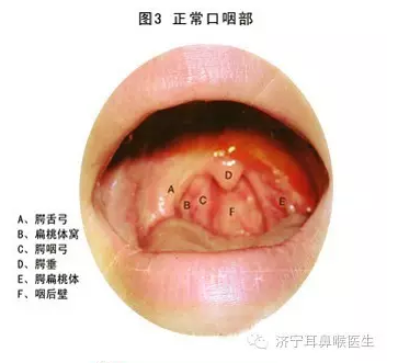 慢性咽炎三天斷根，真相還是幻想？，慢性咽炎三天斷根，真相還是幻想？揭秘治療真相。