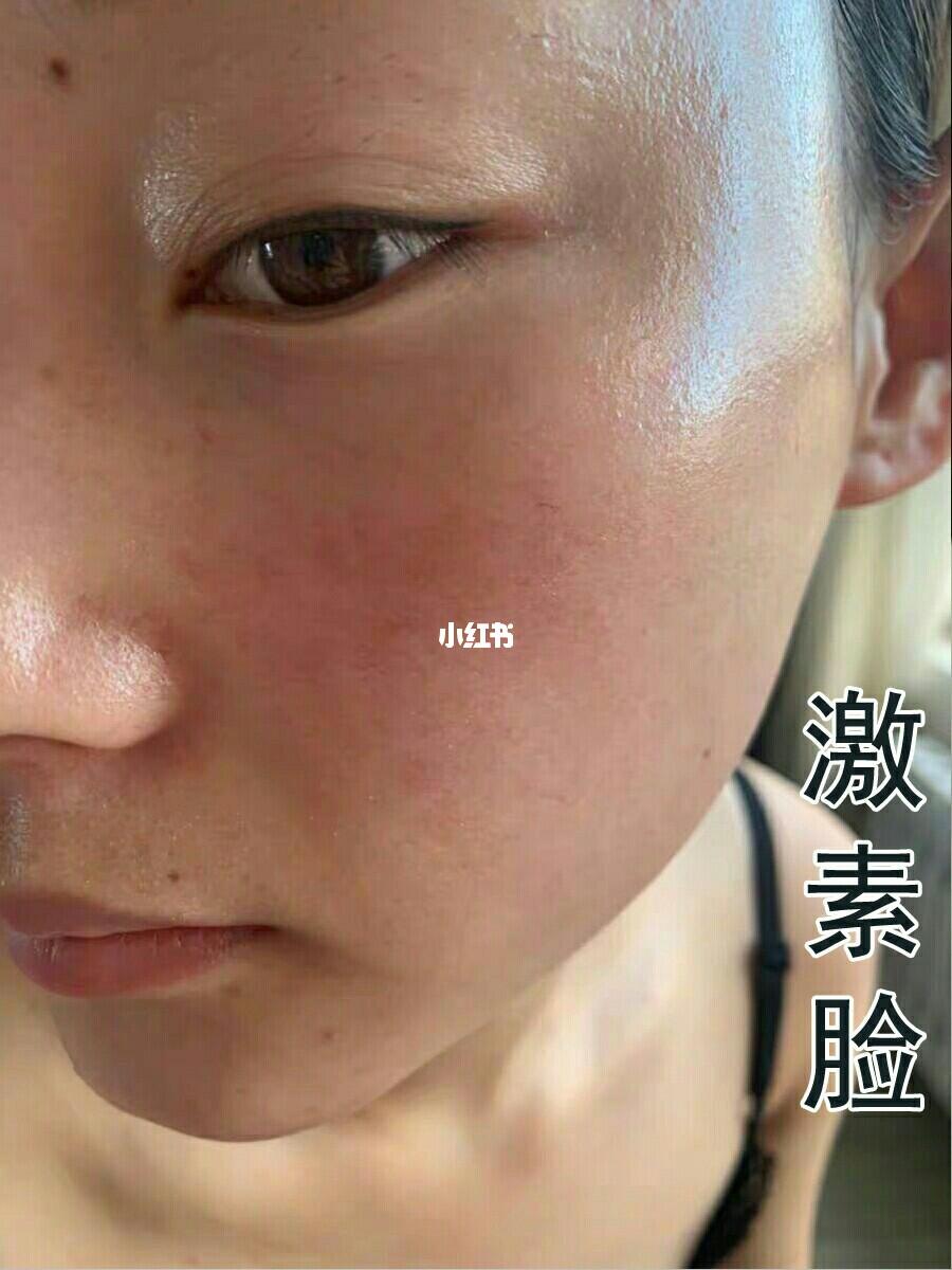 面部激素臉圖片及其相關(guān)問(wèn)題解析，面部激素臉圖片解析及相關(guān)問(wèn)題探討