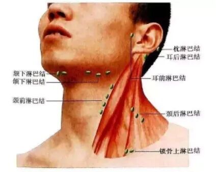 頸部淋巴結(jié)自檢手法，了解、預(yù)防與早期發(fā)現(xiàn)，頸部淋巴結(jié)自檢手法詳解，了解、預(yù)防與早期發(fā)現(xiàn)的重要性