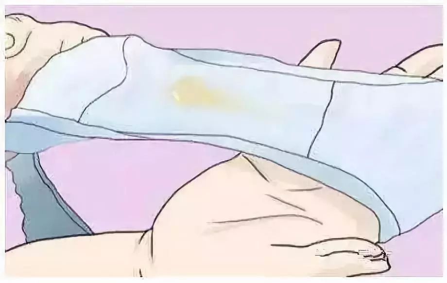 了解女性健康，白帶是什么樣子的圖片詳解，女性健康知識普及，白帶形態(tài)詳解及圖片介紹