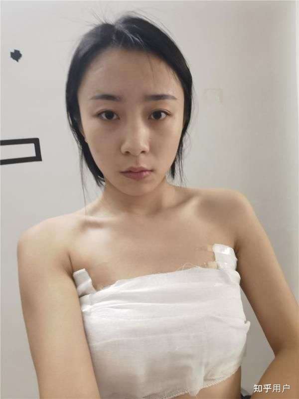 隆胸五年的感受，我的親身經(jīng)歷與體驗(yàn)分享，隆胸五年的真實(shí)感受，我的親身經(jīng)歷與深度體驗(yàn)分享