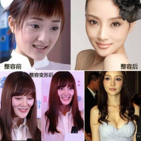 哪些女明星整容？深度解析背后的故事，深度解析女明星整容背后的故事