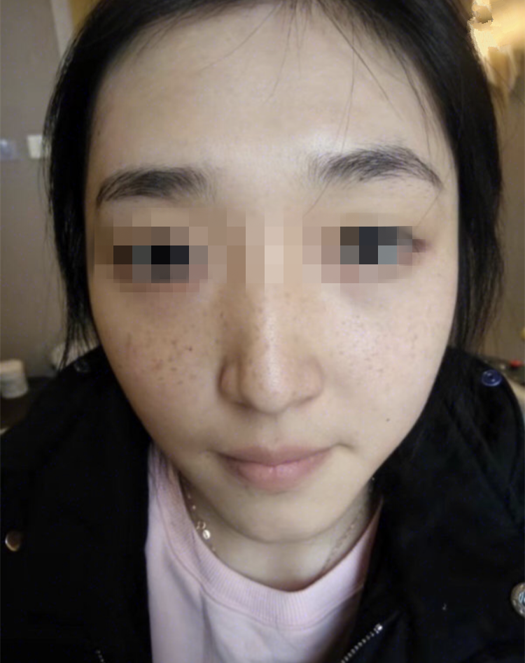 正規(guī)醫(yī)院祛斑效果深度解析，安全與效果的雙重保障，正規(guī)醫(yī)院祛斑效果深度解析，雙重保障下的安全與效果體驗(yàn)