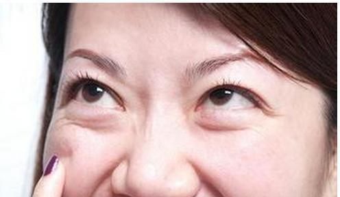 如何消除眼袋，方法與技巧詳解，消除眼袋的有效方法與技巧全解析