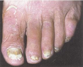 全面解析，100種皮膚病對照表圖片，100種皮膚病對照表圖片，全面解析皮膚病癥狀與類型